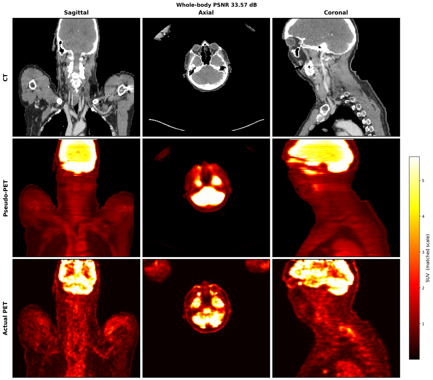 MedFlow: CT-to-PET Image Synthesis
